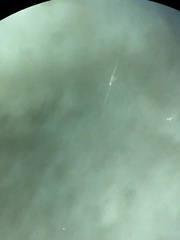 Kellicottia longispina