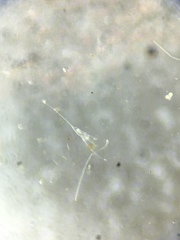 Kellicottia longispina