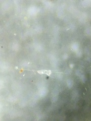 Kellicottia longispina