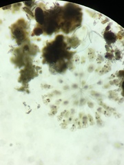 Conochilus hippocrepis