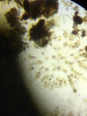 Conochilus hippocrepis