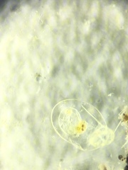 Asplanchna herricki