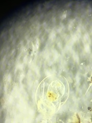 Asplanchna herricki