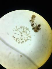 Conochilus hippocrepis