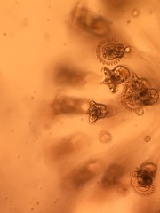 Conochilus hippocrepis