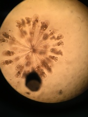 Conochilus hippocrepis