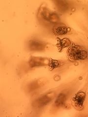 Conochilus hippocrepis