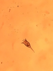 Keratella cochlearis