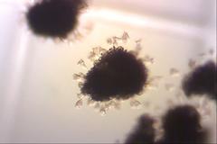 Dolichospermum lemmermannii