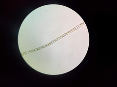 Ulothrix