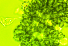 Dolichospermum lemmermannii