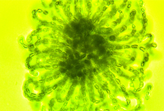 Dolichospermum lemmermannii