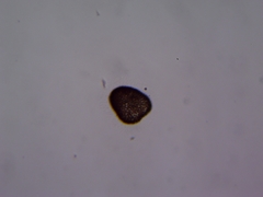 Microcystis