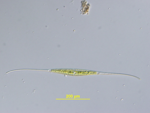 Closterium kuetzingii