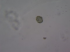 Coelosphaerium