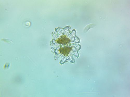 Euastrum verrucosum var. alatum