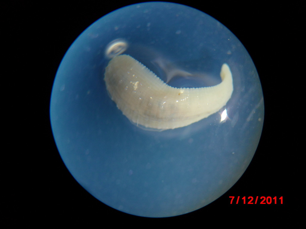 Helobdella octatestisaca