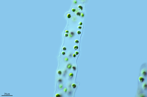 Palmodictyon viride