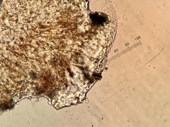 Intralichen lichenum