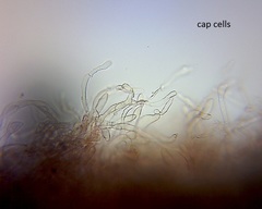 Pseudobaeospora aciculifera