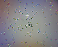 Pseudobaeospora aciculifera