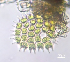 Pseudopediastrum boryanum
