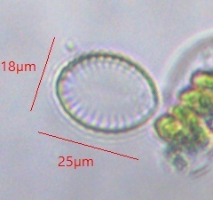 Surirella