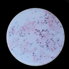 Psathyrella oregonensis