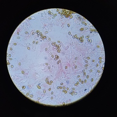 Deconica crobula