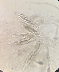 Podospora appendiculata