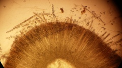 Dissingia leucomelaena