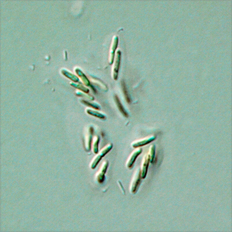 Rhabdogloea