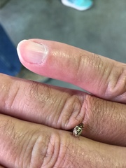 Zygogramma heterothecae