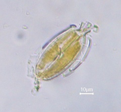Caloneis amphisbaena