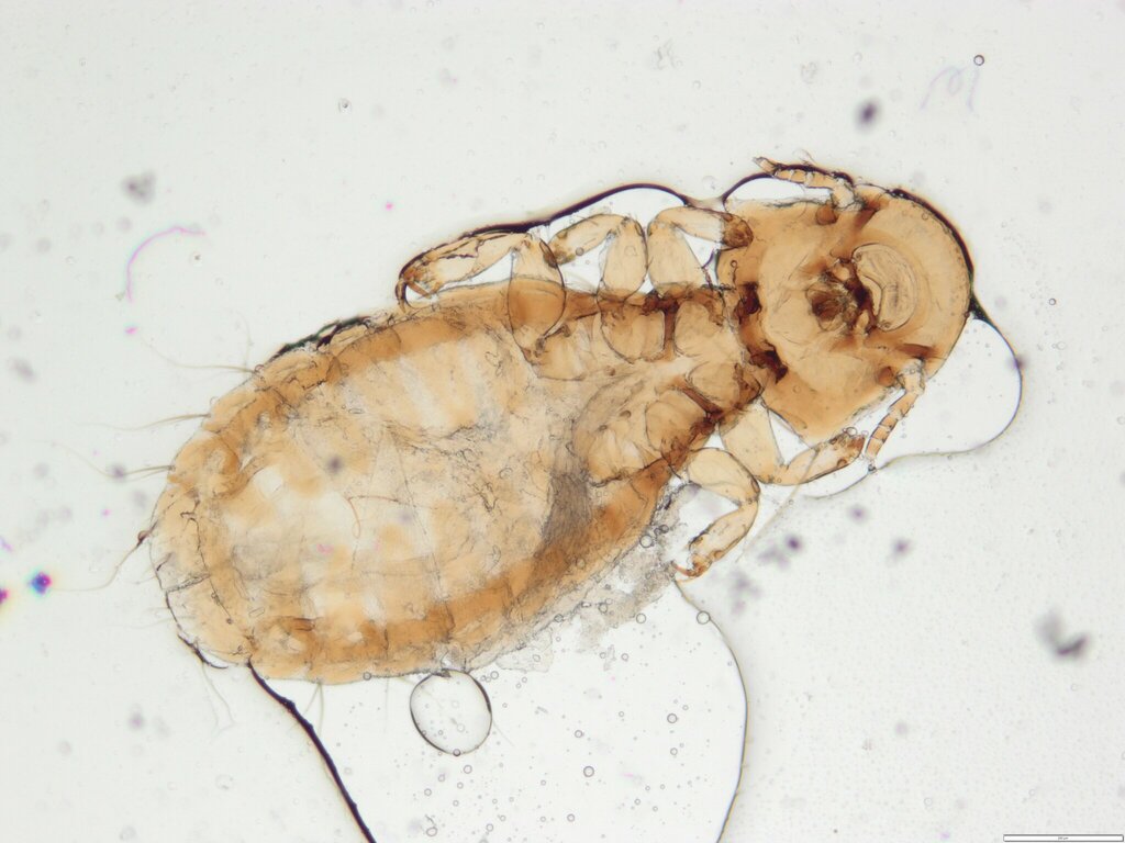 Louse