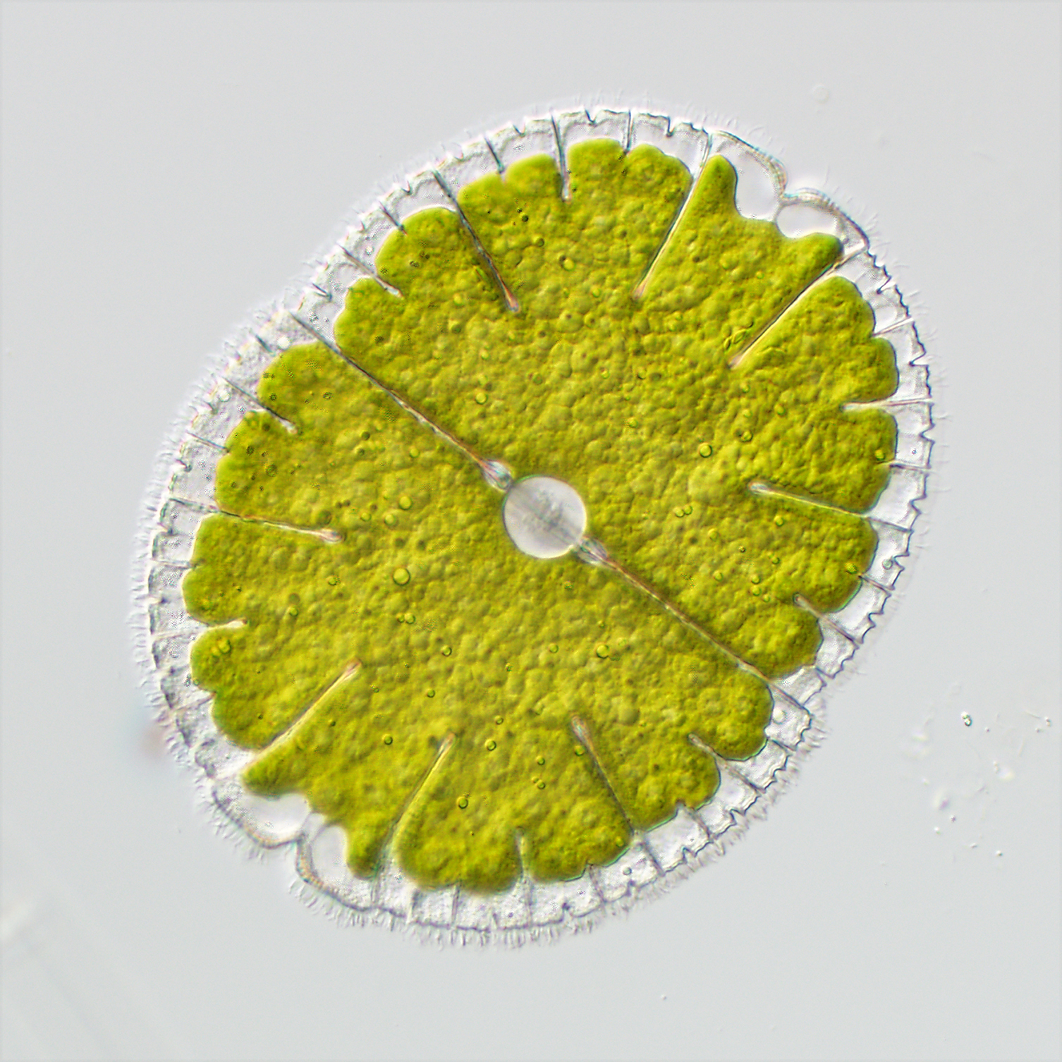 Micrasterias denticulata