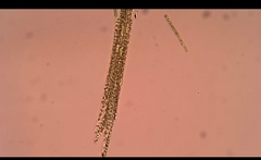 Aphanizomenon flosaquae