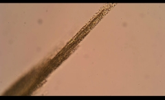Aphanizomenon flosaquae