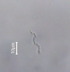 Spirochaetae