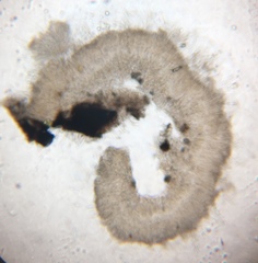 Coccomyces