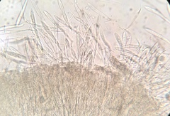 Coccomyces