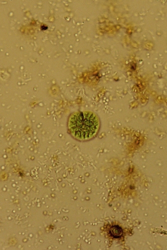 Dicranochaete reniformis