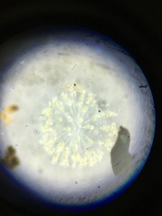 Conochilus hippocrepis