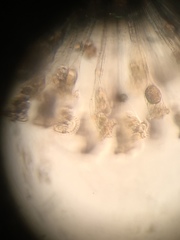 Conochilus hippocrepis