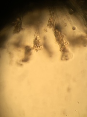 Conochilus hippocrepis