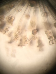 Conochilus hippocrepis