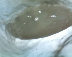 Emerita benedicti
