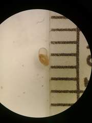 Striatura milium