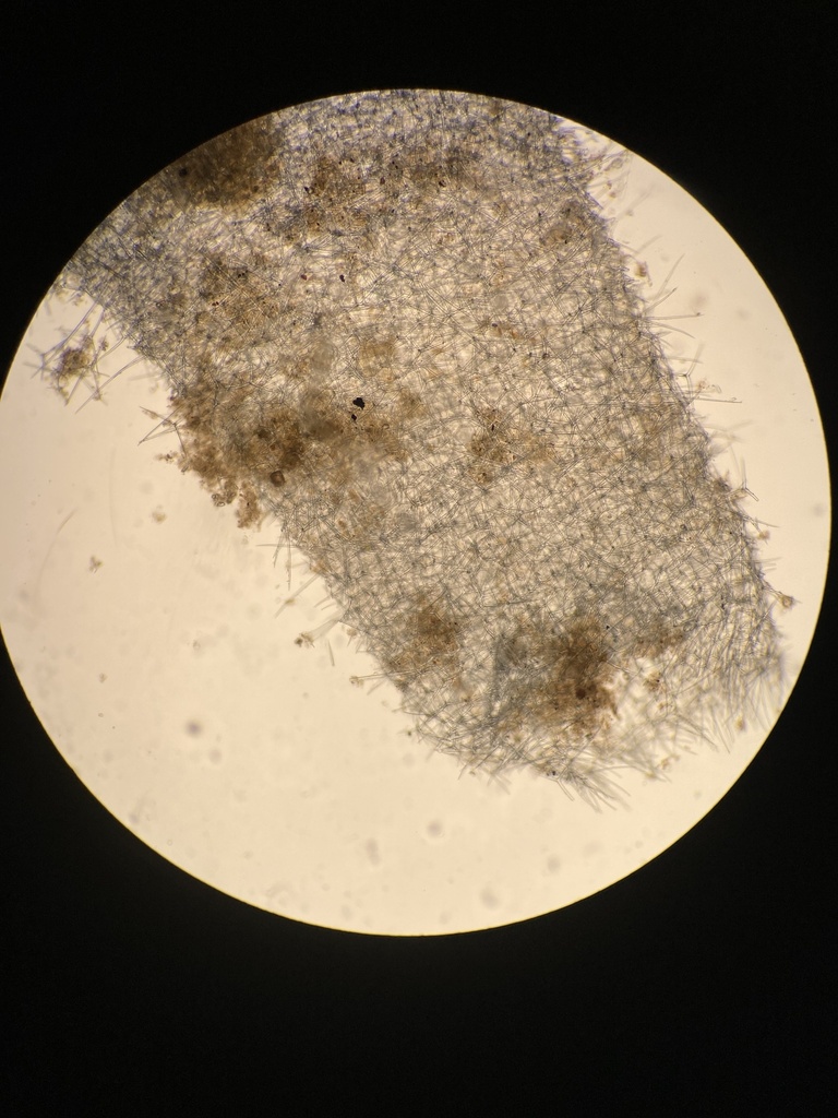 calcareous tube-sponge
