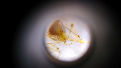 Meotipa spiniventris